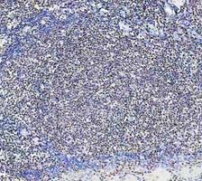 pb9309 parp1 primary antibodies ihc testing 10