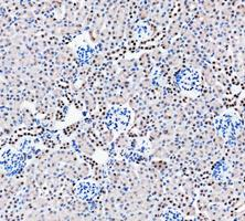 pb9309 parp1 primary antibodies ihc testing 11