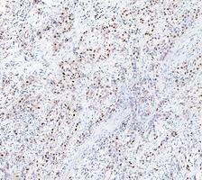 pb9309 parp1 primary antibodies ihc testing 12