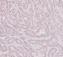 pb9309 parp1 primary antibodies ihc testing 13