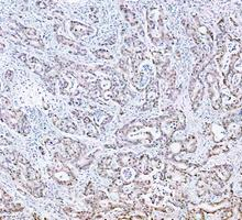 pb9309 parp1 primary antibodies ihc testing 14