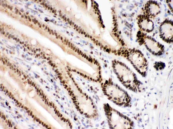  IHC analysis of PARP using anti-PARP antibody (PB9309)