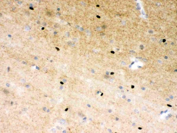 pb9309 parp1 primary antibodies ihc testing 4_1