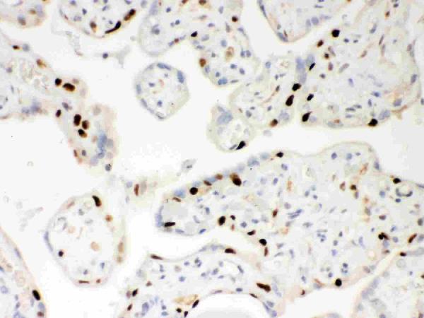 pb9309 parp1 primary antibodies ihc testing 5_1