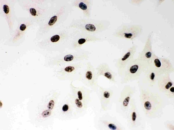 pb9309 parp1 primary antibodies ihc testing 6_1