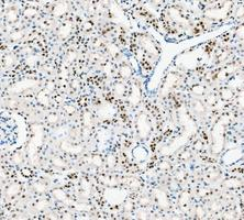 pb9309 parp1 primary antibodies ihc testing 8_1