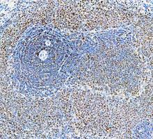 pb9309 parp1 primary antibodies ihc testing 9
