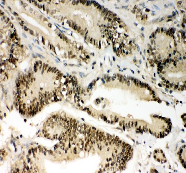 pb9316 pin1 primary antibodies ihc testing 1
