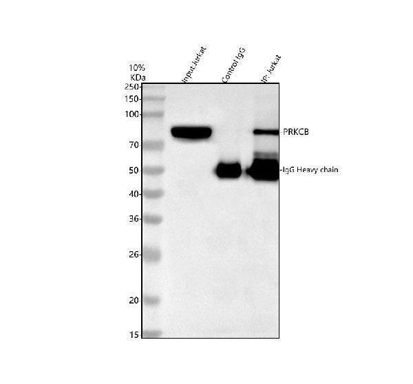 pb9319 prkcb primary antibodies ip testing 1