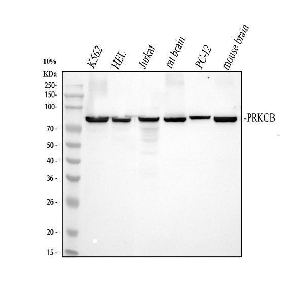 pb9319 prkcb primary antibodies wb testing 1_1