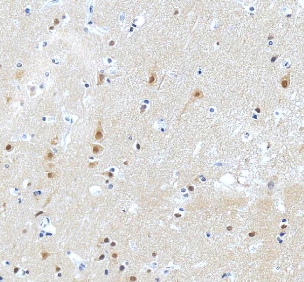 pb9320 prkce primary antibodies ihc testing 4