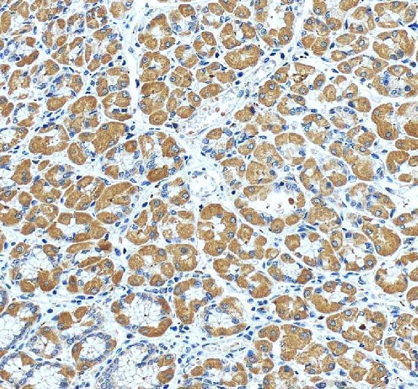 pb9320 prkce primary antibodies ihc testing 5