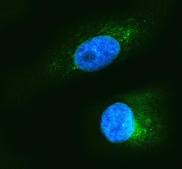pb9325 hsp47 primary antibodies if testing 1