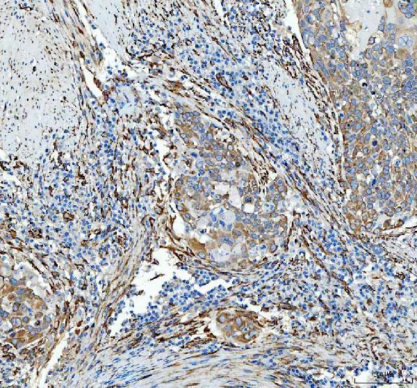 pb9325 hsp47 primary antibodies ihc testing 1