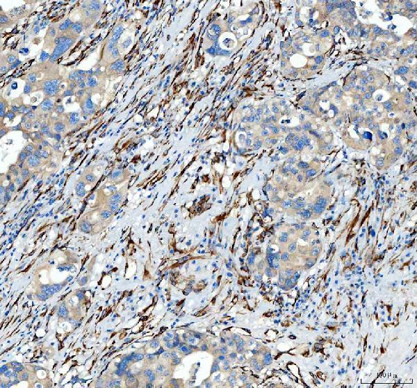 pb9325 hsp47 primary antibodies ihc testing 2