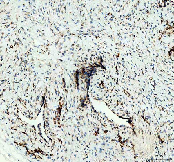 pb9325 hsp47 primary antibodies ihc testing 3