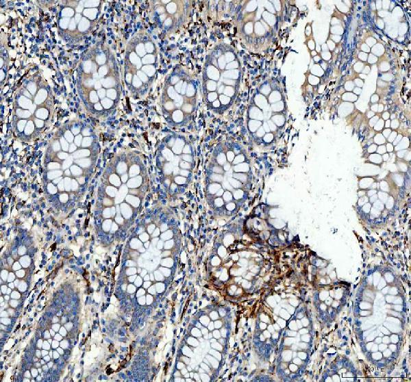 pb9325 hsp47 primary antibodies ihc testing 4