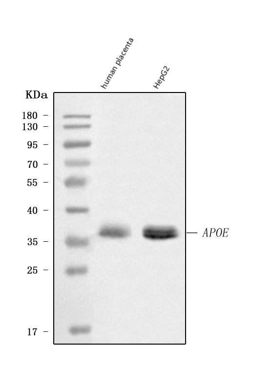  Western blot analysis of Apolipoprotein E using anti-Apolipoprotein E antibody (PB9327)