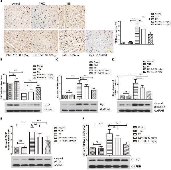 Trimetazidine inhibited EE-induced apoptosis of myocardial cells