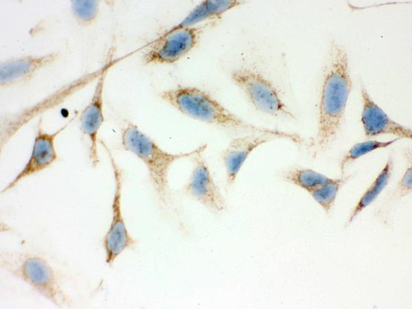 Figure 3. IHC analysis of ERAB using anti-ERAB antibody (PB9336). ERAB was detected in immunocytochemical section of Hela cell. Enzyme antigen retrieval was performed using IHC enzyme antigen retrieval reagent (AR0022) for 15 mins. The cells were blocked with 10% goat serum. And then incubated with 1microg/ml rabbit anti-ERAB Antibody (PB9336) overnight at 4°C. Biotinylated goat anti-rabbit IgG was used as secondary antibody and incubated for 30 minutes at 37°C. The section was developed using Strepavidin-Biotin-Complex (SABC)(Catalog # SA1022) with DAB as the chromogen. Figure 3. IHC analysis of ERAB using anti-ERAB antibody (PB9336). ERAB was detected in immunocytochemical section of Hela cell. Enzyme antigen retrieval was performed using IHC enzyme antigen retrieval reagent (AR0022) for 15 mins. The cells were blocked with 10% goat serum. And then incubated with 1microg/ml rabbit anti-ERAB Antibody (PB9336) overnight at 4°C. Biotinylated goat anti-rabbit IgG was used as secondary antibody and incubated for 30 minutes at 37°C. The section was developed using Strepavidin-Biotin-Complex (SABC)(Catalog # SA1022) with DAB as the chromogen.