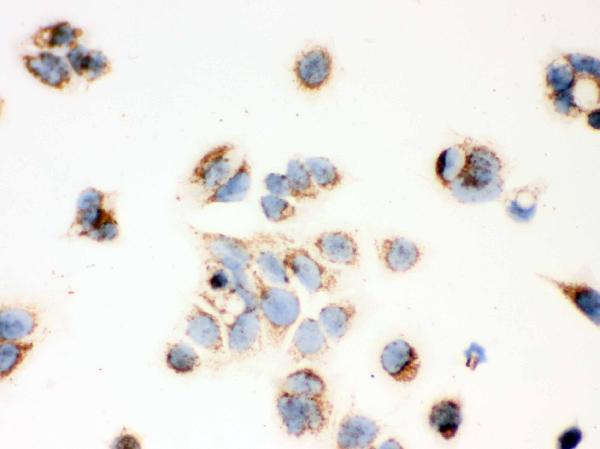 Figure 4. IHC analysis of ERAB using anti-ERAB antibody (PB9336). ERAB was detected in immunocytochemical section of MCF-7 cell. Enzyme antigen retrieval was performed using IHC enzyme antigen retrieval reagent (AR0022) for 15 mins. The cells were blocked with 10% goat serum. And then incubated with 1microg/ml rabbit anti-ERAB Antibody (PB9336) overnight at 4°C. Biotinylated goat anti-rabbit IgG was used as secondary antibody and incubated for 30 minutes at 37°C. The section was developed using Strepavidin-Biotin-Complex (SABC)(Catalog # SA1022) with DAB as the chromogen. Figure 4. IHC analysis of ERAB using anti-ERAB antibody (PB9336). ERAB was detected in immunocytochemical section of MCF-7 cell. Enzyme antigen retrieval was performed using IHC enzyme antigen retrieval reagent (AR0022) for 15 mins. The cells were blocked with 10% goat serum. And then incubated with 1microg/ml rabbit anti-ERAB Antibody (PB9336) overnight at 4°C. Biotinylated goat anti-rabbit IgG was used as secondary antibody and incubated for 30 minutes at 37°C. The section was developed using Strepavidin-Biotin-Complex (SABC)(Catalog # SA1022) with DAB as the chromogen.