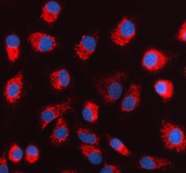 pb9338 mtdh primary antibodies if testing 1