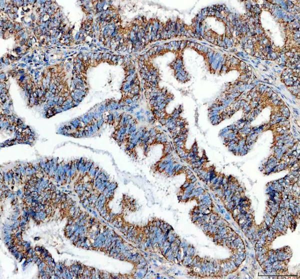 IHC analysis of MTDH using anti-MTDH antibody (PB9338)
