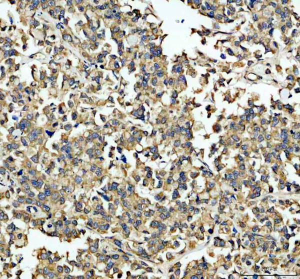 IHC analysis of MTDH using anti-MTDH antibody (PB9338)