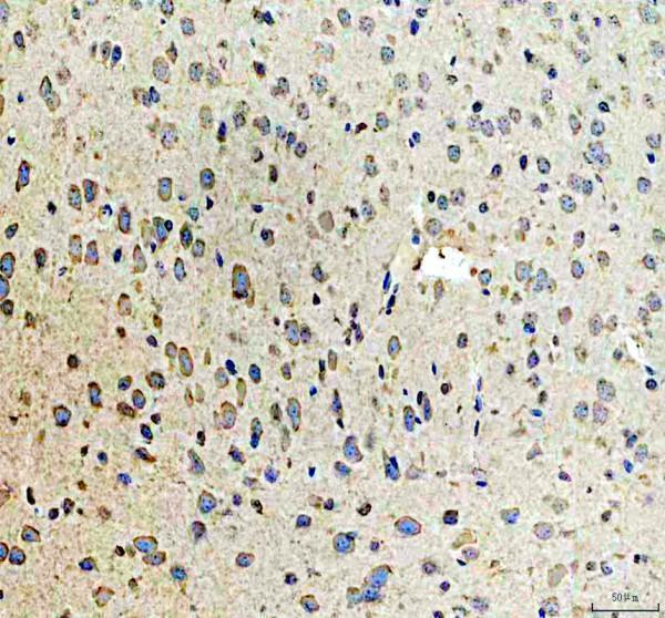 pb9338 mtdh primary antibodies ihc testing 3