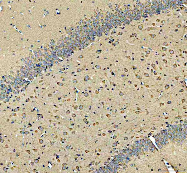 pb9338 mtdh primary antibodies ihc testing 4