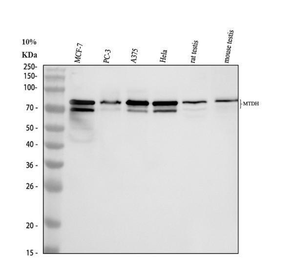Western blot analysis of MTDH using anti-MTDH antibody (PB9338)