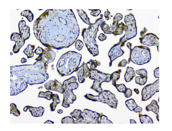 Figure 7. IHC analysis of NMI using anti-NMI antibody (PB9340). NMI was detected in paraffin-embedded section of human placenta tissue. Heat mediated antigen retrieval was performed in EDTA buffer (pH8.0, epitope retrieval solution). The tissue section was blocked with 10% goat serum. The tissue section was then incubated with 1microg/ml rabbit anti-NMI Antibody (PB9340) overnight at 4°C. Biotinylated goat anti-rabbit IgG was used as secondary antibody and incubated for 30 minutes at 37°C. The tissue section was developed using Strepavidin-Biotin-Complex (SABC) (Catalog # SA1022) with DAB as the chromogen.