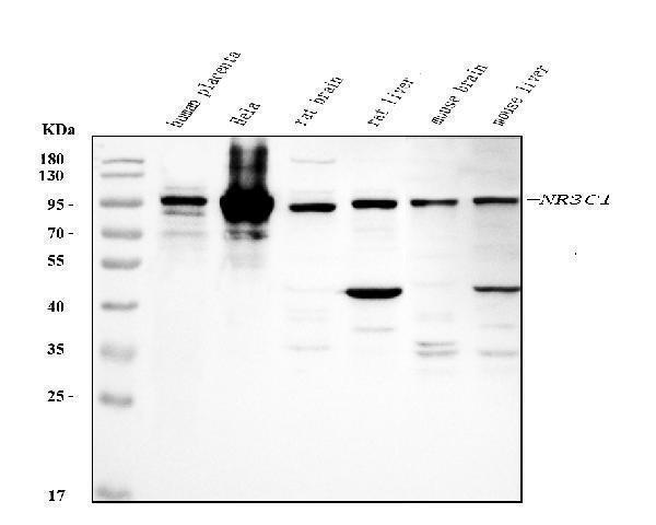 Western blot analysis of NR3C1 using anti-NR3C1 antibody (PB9342)