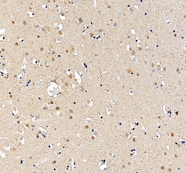 IHC analysis of Otx2 using anti-Otx2 antibody (PB9344)