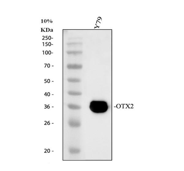 Western blot analysis of Otx2 using anti-Otx2 antibody (PB9344)