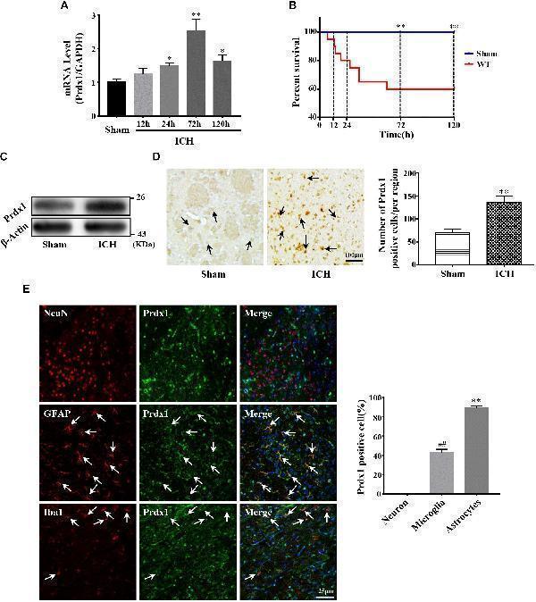 pb9348 fnins 14 00181 g002