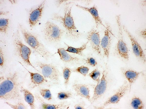 Figure 3. IHC analysis of Peroxiredoxin 3 using anti-Peroxiredoxin 3 antibody (PB9349). Peroxiredoxin 3 was detected in immunocytochemical section of Hela cell. Enzyme antigen retrieval was performed using IHC enzyme antigen retrieval reagent (AR0022) for 15 mins. The cells were blocked with 10% goat serum. And then incubated with 1microg/ml rabbit anti-Peroxiredoxin 3 Antibody (PB9349) overnight at 4°C. Biotinylated goat anti-rabbit IgG was used as secondary antibody and incubated for 30 minutes at 37°C. The section was developed using Strepavidin-Biotin-Complex (SABC)(Catalog # SA1022) with DAB as the chromogen.