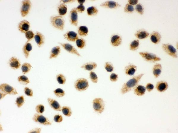 Figure 5. IHC analysis of Peroxiredoxin 3 using anti-Peroxiredoxin 3 antibody (PB9349). Peroxiredoxin 3 was detected in immunocytochemical section of SMMC-7721 cell. Enzyme antigen retrieval was performed using IHC enzyme antigen retrieval reagent (AR0022) for 15 mins. The cells were blocked with 10% goat serum. And then incubated with 1microg/ml rabbit anti-Peroxiredoxin 3 Antibody (PB9349) overnight at 4°C. Biotinylated goat anti-rabbit IgG was used as secondary antibody and incubated for 30 minutes at 37°C. The section was developed using Strepavidin-Biotin-Complex (SABC)(Catalog # SA1022) with DAB as the chromogen.