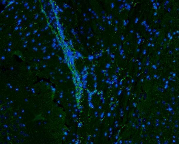 pb9359 vimentin primary antibodies if testing 11