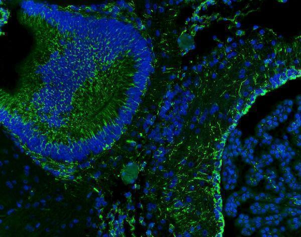 pb9359 vimentin primary antibodies if testing 12