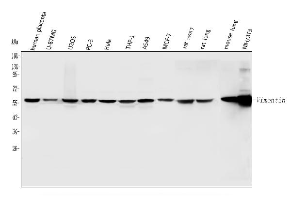 Figure 1. Western blot analysis of Vimentin using anti-Vimentin antibody (PB9359). Electrophoresis was performed on a 5-20% SDS-PAGE gel at 70V (Stacking gel) / 90V (Resolving gel) for 2-3 hours. The sample well of each lane was loaded with 30 ug of sample under reducing conditions. Lane 1: human placenta tissue lysates, Lane 2: human U-87MG whole cell lysates, Lane 3: human U20S whole cell lysates, Lane 4: human PC-3 whole cell lysates, Lane 5: human Hela whole cell lysates, Lane 6: human THP-1 whole cell lysates, Lane 7: human A549 whole cell lysates, Lane 8: human MCF-7 whole cell lysates, Lane 9: rat ovary tissue lysates, Lane 10: rat lung tissue lysates, Lane 11: mouse lung tissue lysates, Lane 12: mouse NIH/3T3 whole cell lysates. After electrophoresis, proteins were transferred to a nitrocellulose membrane at 150 mA for 50-90 minutes. Blocked the membrane with 5% non-fat milk/TBS for 1.5 hour at RT. The membrane was incubated with rabbit anti-Vimentin antigen affinity purified polyclonal antibody (Catalog # PB9359) at 0.5 microg/mL overnight at 4°C, then washed with TBS-0.1%Tween 3 times with 5 minutes each and probed with a goat anti-rabbit IgG-HRP secondary antibody at a dilution of 1:5000 for 1.5 hour at RT. The signal is developed using an Enhanced Chemiluminescent detection (ECL) kit (Catalog # EK1002) with Tanon 5200 system. A specific band was detected for Vimentin at approximately 54 kDa. The expected band size for Vimentin is at 54 kDa.