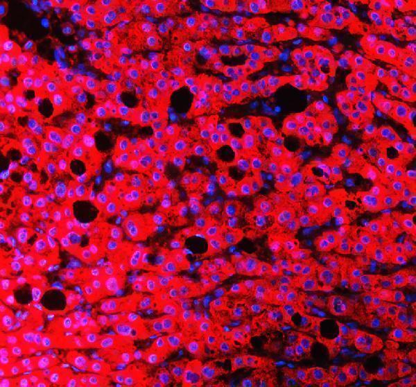 IF analysis of RBP4 using anti-RBP4 antibody (PB9360)