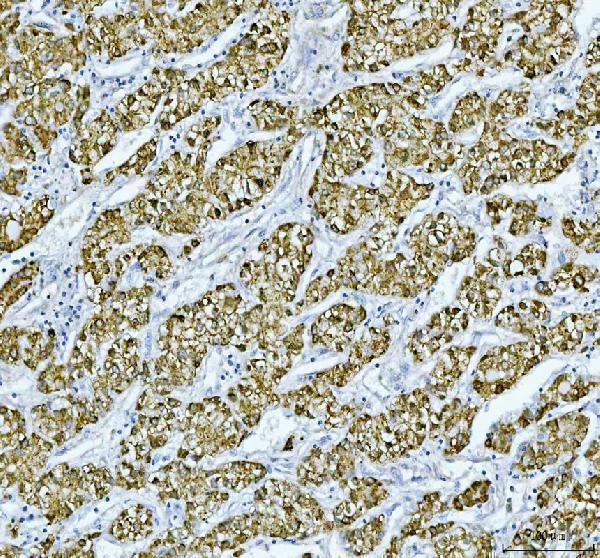 IHC analysis of RBP4 using anti-RBP4 antibody (PB9360)
