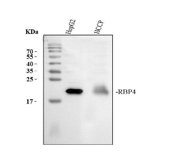 Western blot analysis of RBP4 using anti-RBP4 antibody (PB9360)
