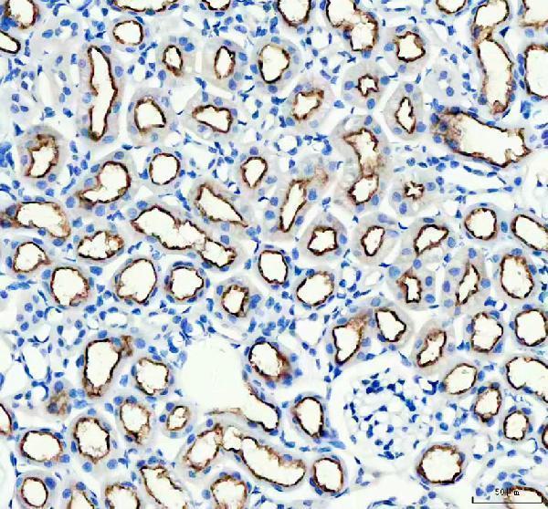 pb9364 abcg2 primary antibodies ihc testing 1