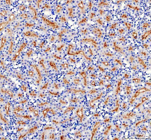 pb9364 abcg2 primary antibodies ihc testing 2