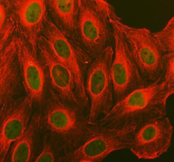 pb9370 ccnd1 primary antibodies if testing 1