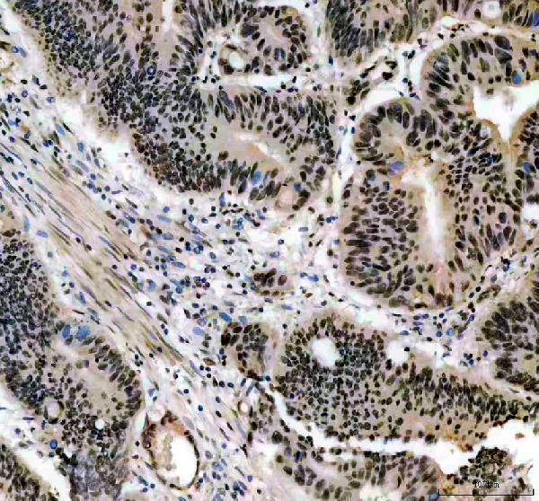 IHC analysis of CCND1 using anti-CCND1 antibody (PB9370)
