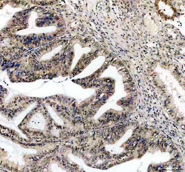 IHC analysis of CCND1 using anti-CCND1 antibody (PB9370)