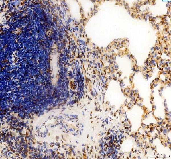 pb9370 ccnd1 primary antibodies ihc testing 3